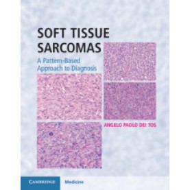 Soft Tissue Sarcomas Hardback with Online Resource,Angelo Paolo Dei Tos,Cambridge University Press,9781107040809,