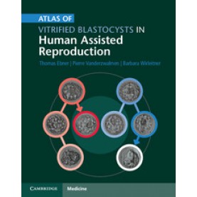 Atlas of Vitrified Blastocysts in Human Assisted Reproduction,Thomas Ebner,Cambridge University Press,9781107074095,