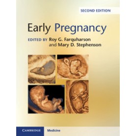 Early Pregnancy 2/ed,Roy G. Farquharson,Cambridge University Press,9781107082014,