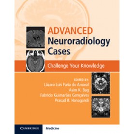 Advanced Neuroradiology Cases-Challenge Your Knowledge-AMARAL-Cambridge University Press-9781107088719