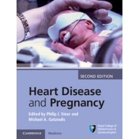 Heart Disease and Pregnancy,Philip J. Steer,Cambridge University Press,9781107095946,