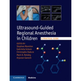 Ultrasound-Guided Regional Anesthesia in Children,Stephen Mannion,Cambridge University Press,9781107098770,