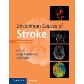 Uncommon Causes of Stroke 3ED,Louis Caplan , José Biller,Cambridge University Press,9781107147447,