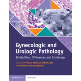 Gynecologic and Urologic Pathology,Edited by Maria Rosaria Raspollini , Antonio Lopez-Beltran,Cambridge University Press,9781107170452,