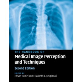 The Handbook of Medical Image Perception and Techniques,Edited by Ehsan Samei , Elizabeth A. Krupinski,Cambridge University Press,9781107194885,