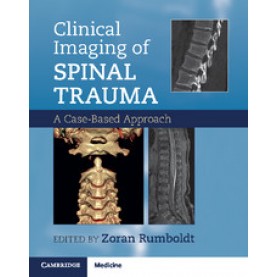 Clinical Imaging of Spinal Trauma,Edited by Zoran Rumboldt , Alessandro Cianfoni , Abhay Varma,Cambridge University Press,9781107427471,
