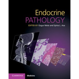 Endocrine Pathology with Online Resource,Ozgur Mete,Cambridge University Press,9781107443310,