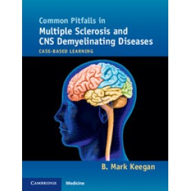 Common Pitfalls in Multiple Sclerosis and CNS Demyelinating Diseases,B. Mark Keegan,Cambridge University Press,9781107680401,