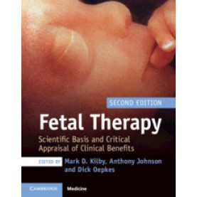 Fetal Therapy,Edited by Mark D. Kilby , Anthony Johnson , Dick Oepkes,Cambridge University Press,9781108474061,