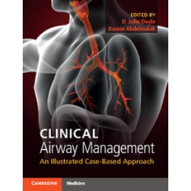 Clinical Airway Management,D. John Doyle,Cambridge University Press,9781316601358,