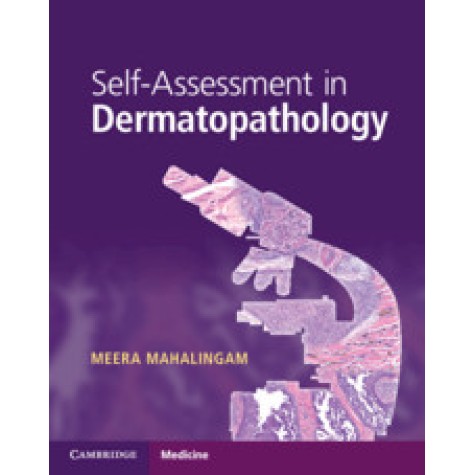 Self-Assessment in Dermatopathology,Meera Mahalingam,Cambridge University Press,9781316622872, Self-Assessment in Dermatopathology,Meera Mahalingam,Cambridge University Press,9781316622872,