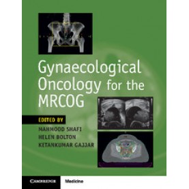 Gynaecological Oncology for the MRCOG,Mahmood Shafi,Cambridge University Press,9781316638712,