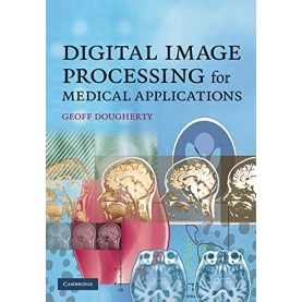 Digital Image Processing for Medical Applications South Asian edition,Geoff Dougherty,Cambridge University Press,9780521181938,